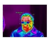 2× πραγματικός - κάμερα θερμικής λήψης εικόνων Vox FPA χρονικών ηλεκτρονική ζουμ μη ψυχόμενη για τη μέτρηση θερμοκρασίας σώματος